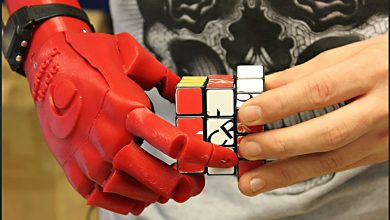 prosthetic hand
